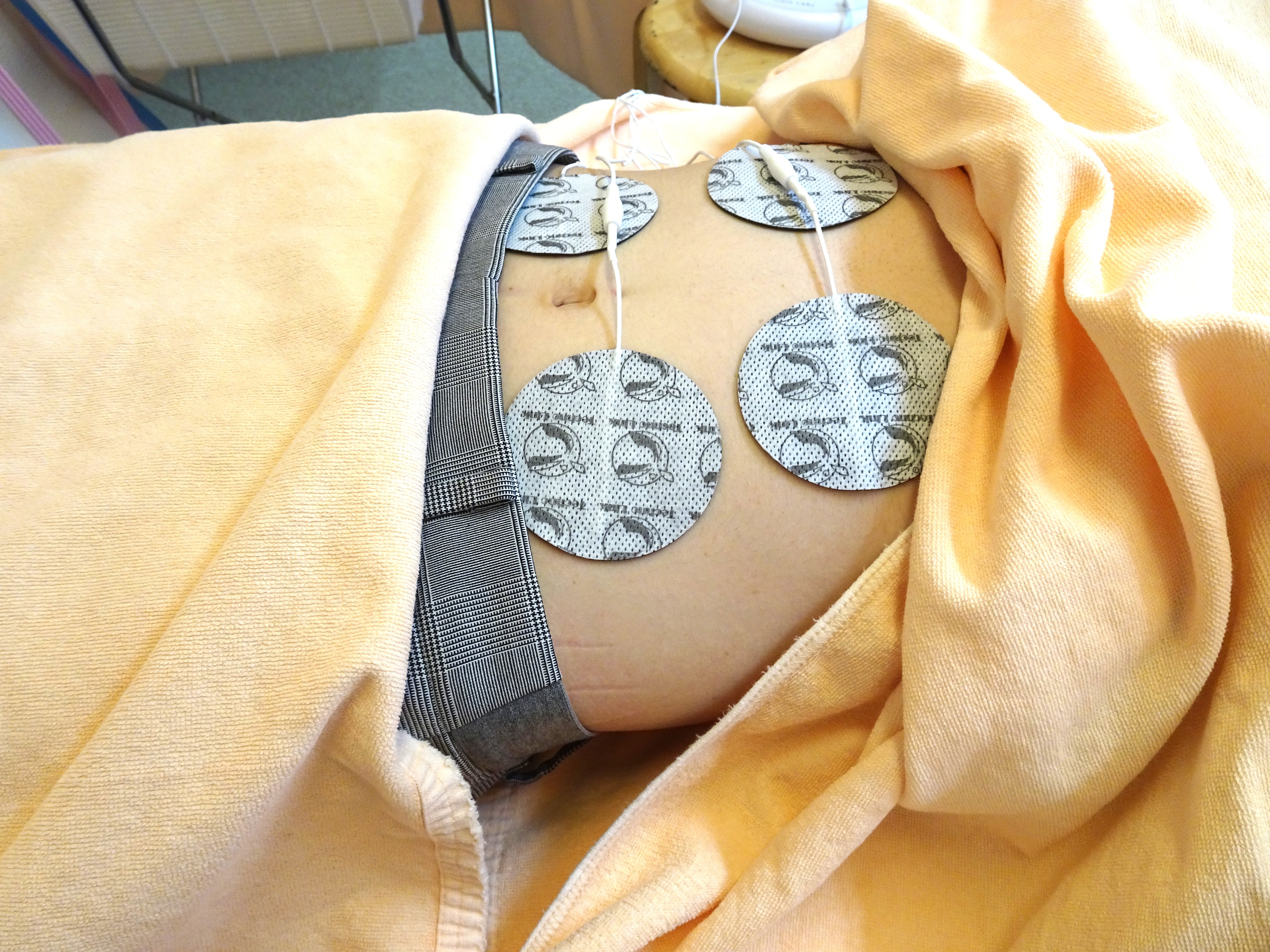 予防のための施術